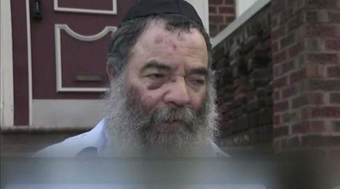"הוא צעק 'יהודי-יהודי'": הרב שהותקף בניו יורק משחזר