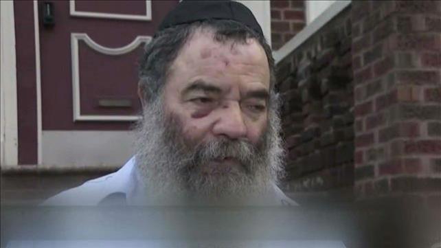 "הוא צעק 'יהודי-יהודי': הרב שהותקף בניו יורק משחזר