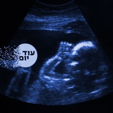 עובר (אילוסטרציה)