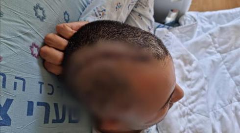 צעיר מירושלים מואשם בתקיפה חמורה בירושלים