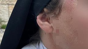 הנזירה שהותקפה סמוך לקבר דוד בירושלים