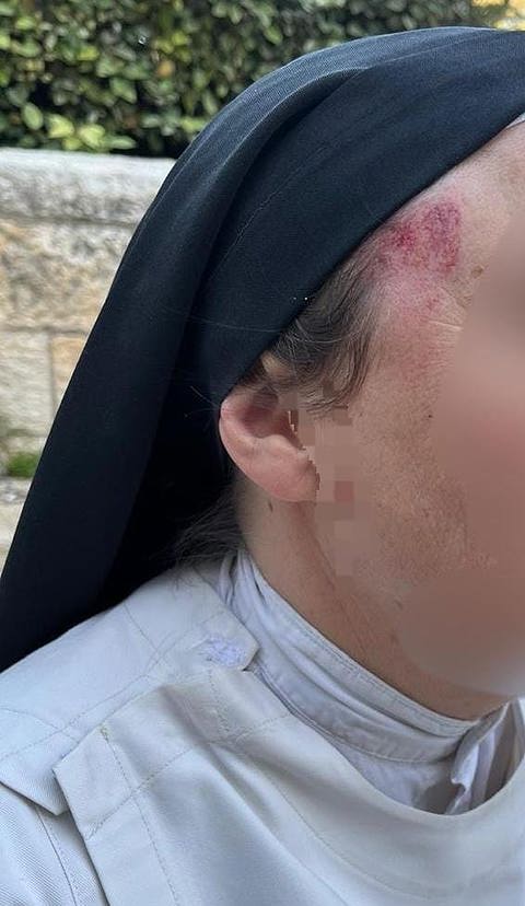 הנזירה שהותקפה סמוך לקבר דוד בירושלים