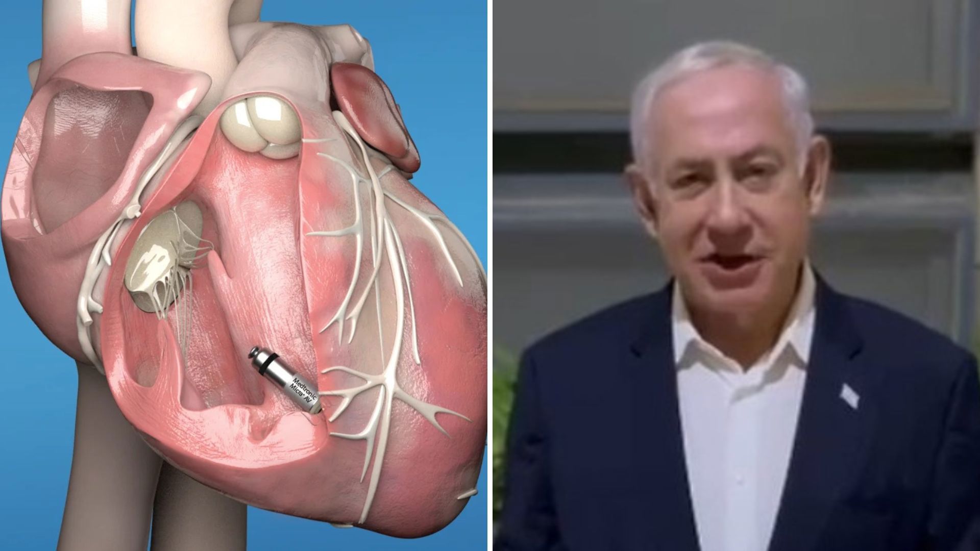 נתניהו והקוצב