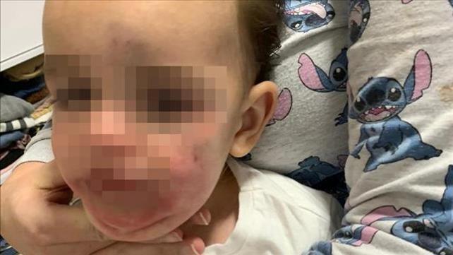 ילדה שהוריה הגישו תלונה על התעללות בגן ילדים בבאר שבע, 23.02.21