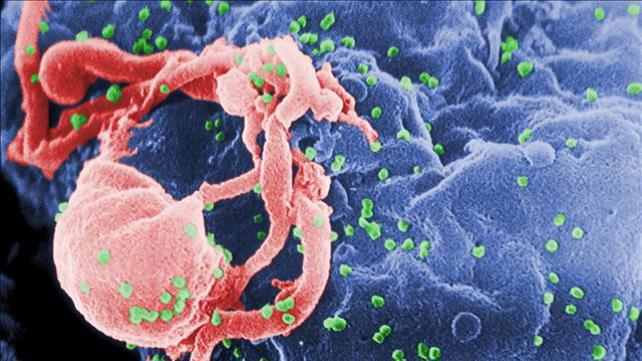 איידס, נגיף HIV, וירוס