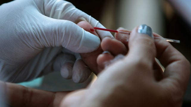 בדיקת HIV