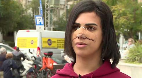 "אמר שיחסל אותנו": הצעירה הטרנסג'נדרית שהותקפה ברמאללה משחזרת